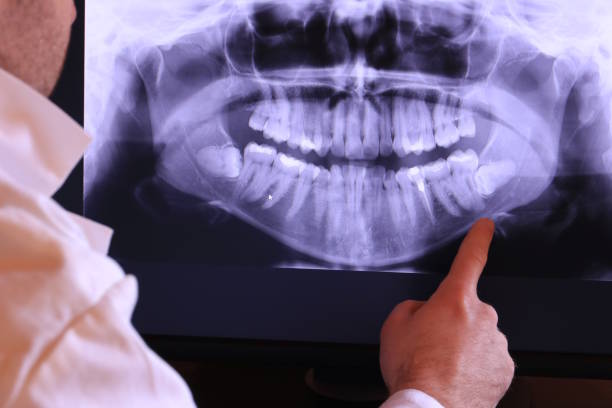 Best Weekend Emergency Dentist in Lakewood, OH