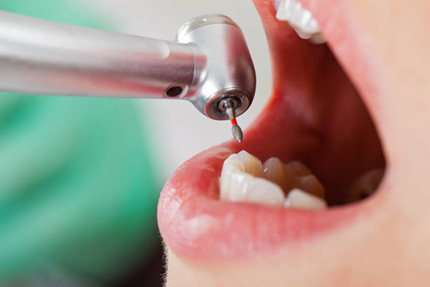 Best Emergency Dentist for Knocked-Out Tooth in Lakewood, OH